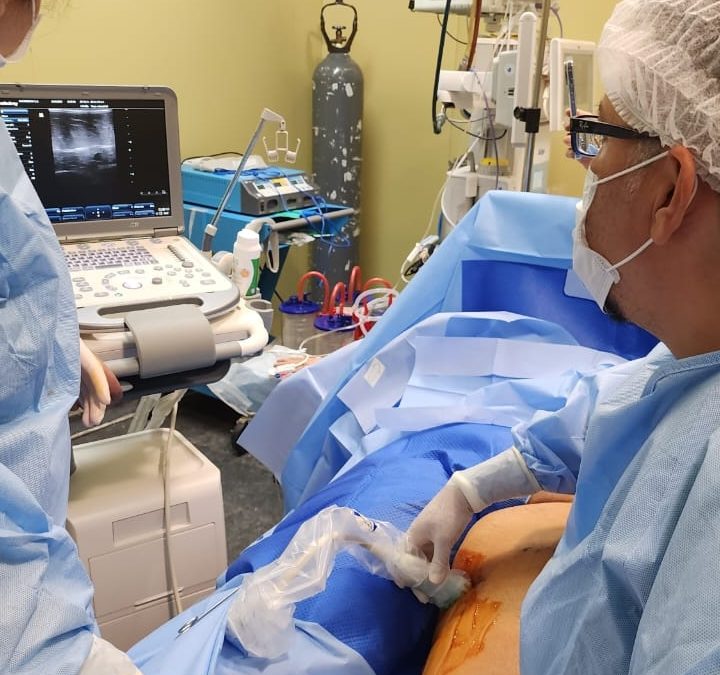 Hospital Claudio Vicuña realizó primera cirugía vascular con láser para eliminar várices